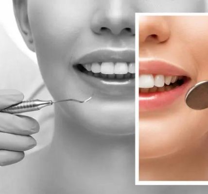 Beyond the Checkup Compassionate Care for Dental Anxiety Patients
