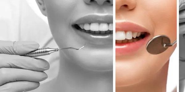 Beyond the Checkup Compassionate Care for Dental Anxiety Patients